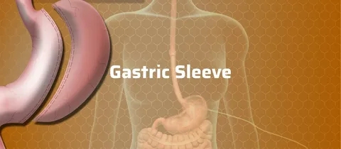 best gastric sleeve surgeon Melbourne